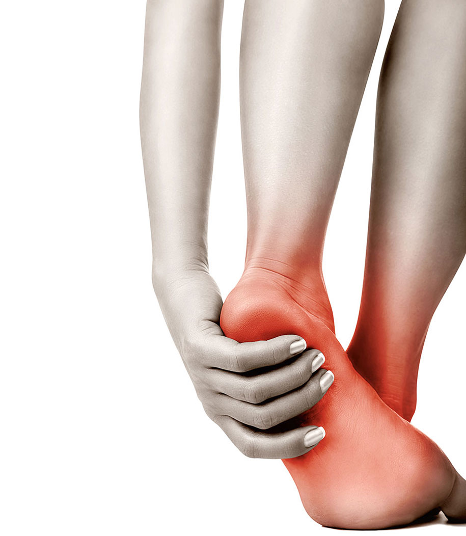 Flat feet